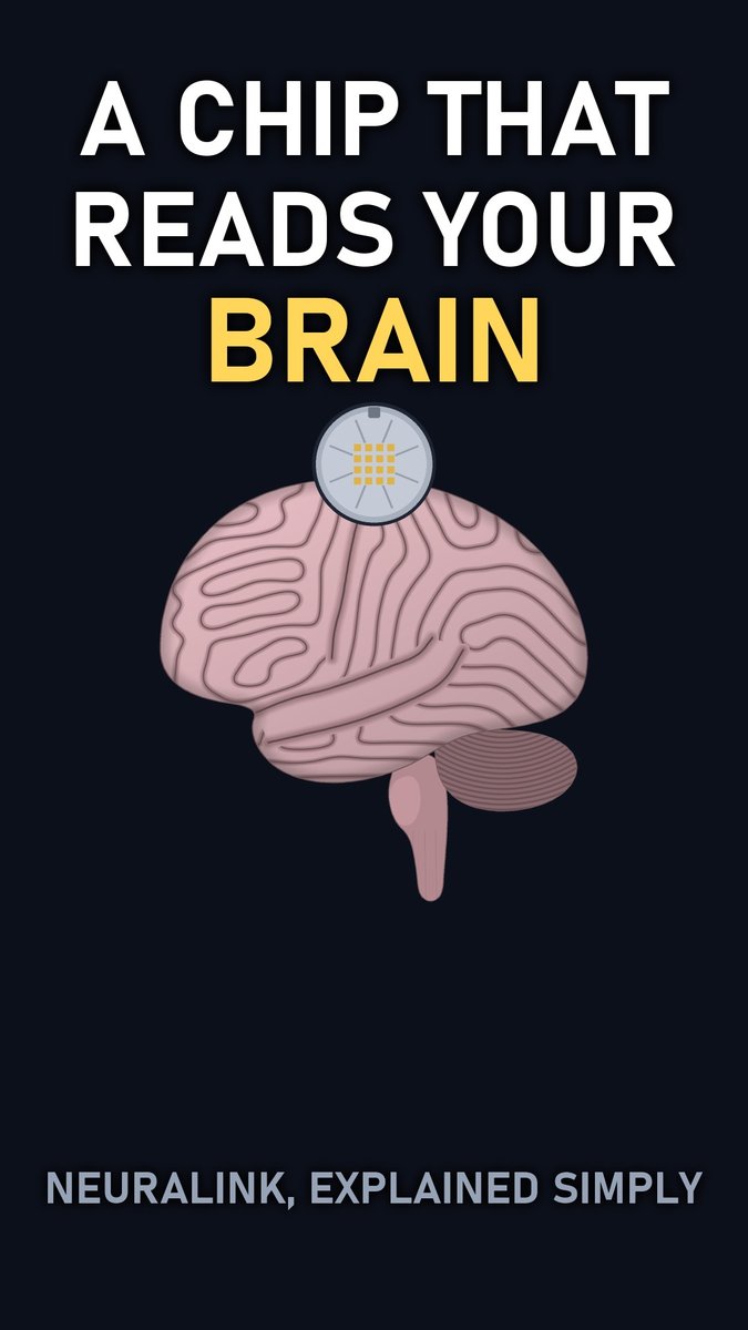 How Does Neuralink Work? (It Doesn't Fix the Spinal Cord) — video thumbnail
